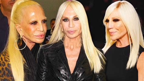 donatella versace amici|donatella versace face what happened.